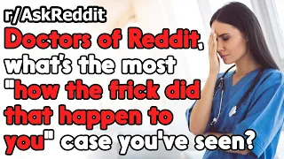 Doctors, what's the most "how did that happen" case you've seen? r/AskReddit | Reddit Jar