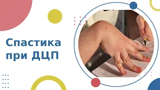 🤚 Спастика мышц у детей при ДЦП, различные подходы к лечению. Спастика у детей с ДЦП. 18+