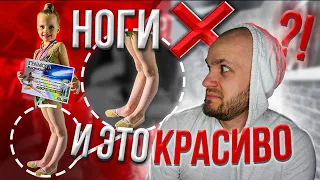 Реакция тренера на Ноги "ИКСЫ". Как РАЗВИТЬ? / Переразгибание полезно? Таня+танцы