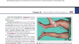 Puerperal Thrombosis