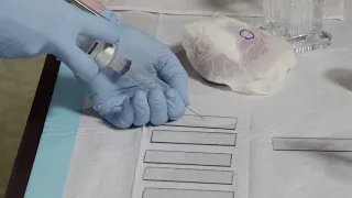 Fine Needle Aspiration Biopsy (FNA) Techniques - Smear Preparation