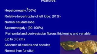 Doppler Sonography in the Evaluation of Liver Diseases