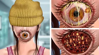 ASMR Remove the Parasitic Giant Eye & Maggots on the mouth | Deep Cleaning Animation