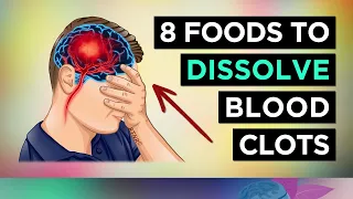 Top 8 Foods That DISSOLVE Blood Clots (Naturally)