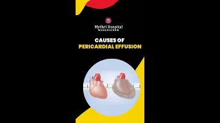 Causes of Pericardial Effusion | Diagnosis & Treatment | Mythri Hospital Mehdipatnam #shorts