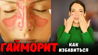 ГАЙМОРИТ - как избавиться. Психосоматика гайморита.