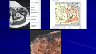 Imaging of Hip joint   Prof Dr  Salwa Fathy In Arabic