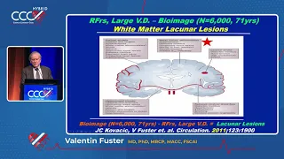 Systemic Atherosclerosis - Dr. Valentin Fuster