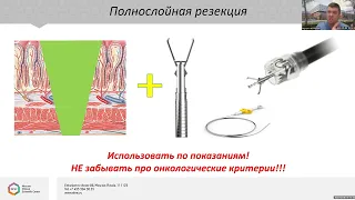 Эндоскопическая хирургия I Московское онкологическое общество