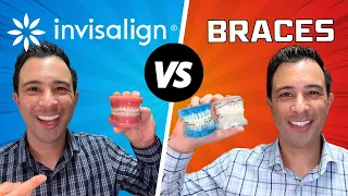 Can Invisalign Get a BETTER Result Than Braces?