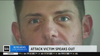 Man attacked by group of teens in Long Beach speaks out