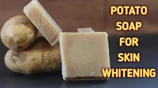 Homemade Potato Soap for Acne Scars,Suntan,Hyperpigmentation & Skin Whitening.•||BEAUTY BY BETTY||•