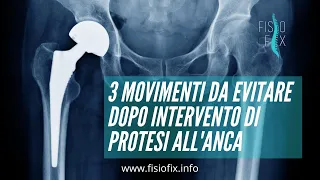 Protesi d'anca: quali movimenti bisogna evitare?