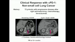 James P. Allison, Ph.D., on Targeting Immune Checkpoints in Cancer Therapy