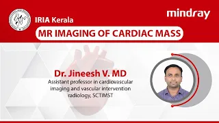 Kerala IRIA webinar on MR Imaging of Cardiac Mass | Dr. Jineesh V. MD | SCTIMST