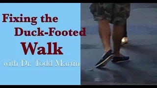 How to Fix the Duck-Footed Walk: with Full Corrective Exercise