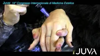 Dermapen Micro Needling al Congresso Internazionale di Medicina Estetica (Bi-Medica)
