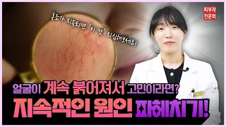 📌얼굴이 계속 붉어져서😡고민이라면?🤔💭 🪄지속적인 원인이 ✅무엇인지 🔎하나하나 다 알려드려요!🔍 [송도휴먼피부과]