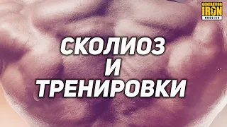 СКОЛИОЗ И ТРЕНИРОВКИ