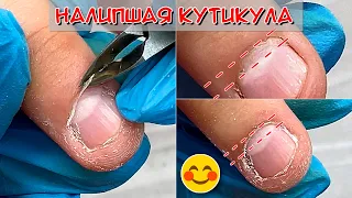 Налипшая кутикула / Работа с налипшей кутикулой на тонких ногтях