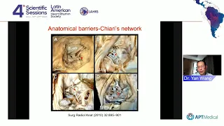 From 3D curve decapolar catheter, to more - LAHRS 2021