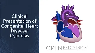 "Clinical Presentation of Congenital Heart Disease: Cyanosis" by Michael Freed, MD