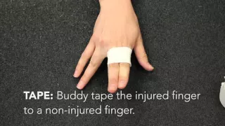 How do you treat a jammed finger?