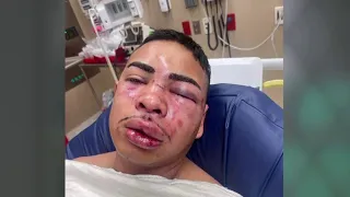 Detention officer speaks out after being attacked by Harris County Jail inmate