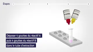 Vidéo de démonstration du TROD'ANGINE® - AAZ