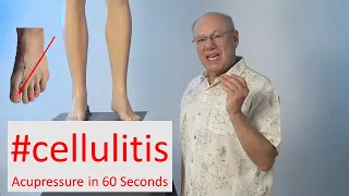 #cellulitis - Acupressure in 60 Seconds