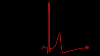 #Футаж кардиограмма сердца ◄4K•HD► #Footage heart cardiogram