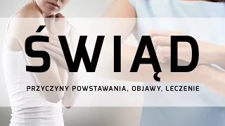 MIRALEX e-TV ODC. 4 ŚWIĄD - PRZYCZYNY POWSTAWANIA, OBJAWY, LECZENIE