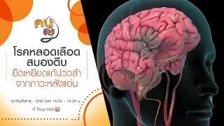 โรคหลอดเลือดสมองตีบ, ยืดเหยียดแก้ปวดล้าจากภาวะหลังแอ่น : คนสู้โรค (15 ต.ค. 62)