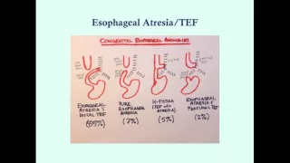 Newborn Gastrointestinal Disorders (Part 1) - CRASH! Medical Review Series