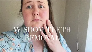 Getting My Wisdom Teeth Out (Hot Mess) | Shelly Coco