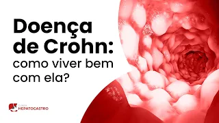 Doença de Crohn: como viver bem com ela?| Clínica Hepatogastro