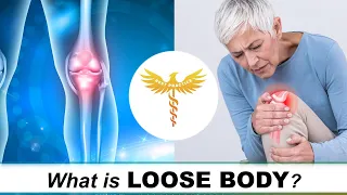 What is a Loose Body? (Knee)