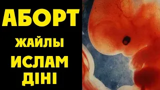 АБОРТ жайлы ИСЛАМ дінінде