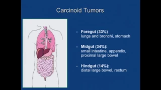 Yale Cancer Center Grand Rounds: Matthew Kulke, MD