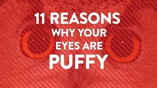 11 Reasons Why Your Eyes Are Puffy | Health