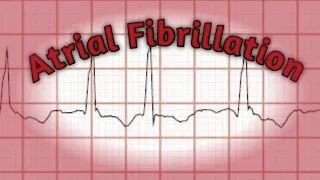 CVS Medicine Lecture 22 | Atrial Fibrillation made easy