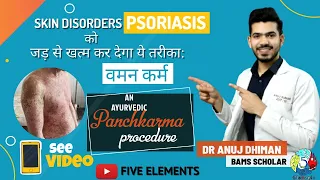 Psoriasis Treatment by Ayurvedic Panchkarma procedure: Vaman(वमन कर्म )  #Psoriasis#Panchkarma#Ayush