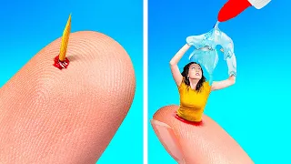 OH NOO! 😬 If a SPLINTER WERE A PERSON!😼 || SURVIVAL FIRST AID HACKS AND GADGETS