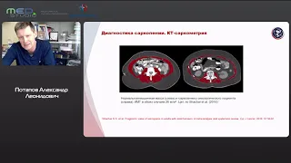 Саркопения у онкологических пациентов и возможные пути ее комплексной коррекции