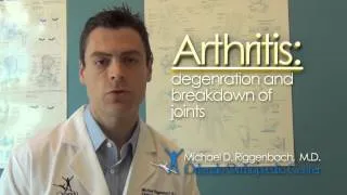 What is Arthritis of the Hand?