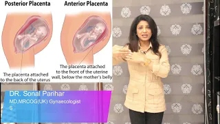 Low lying placenta आंवल का नीचे होना , ऐसे में normal delivery  हो सकती है ?