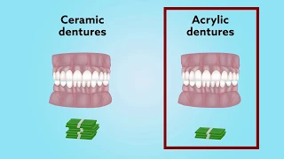 Long-term comparison of acrylic vs. ceramic All-on-4® fixed dentures