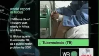 CNN International Report on Efforts to Control MDR-TB in India