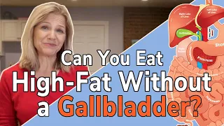 Can I Eat High Fat Without a Gallbladder?
