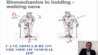 Biomechanics of Hip Joint